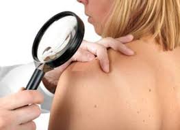 ΔΕΡΜΑΤΟΛΟΓΟΣ ΑΦΡΟΔΙΣΙΟΛΟΓΟΣ ΜΕΣΟΛΟΓΓΙ ΚΑΡΕΤΣΟΥ ΒΑΛΤΣΙΣΤΑ ΑΓΓΕΛΙΚΗ