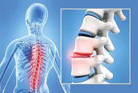 ΝΕΥΡΟΧΕΙΡΟΥΡΓΟΣ ΜΑΡΟΥΣΙ ΑΤΤΙΚΗ ΚΙΚΕΜΠΟΥΣ ΓΙΟΧΕΝ